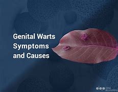 Image result for What Causes Genital Warts