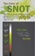 Image result for Sinus Mucus Color Chart