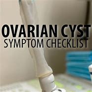 Image result for Ovarian Cyst Stomach Bloating
