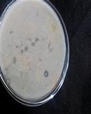 Image result for Pplantar Fibroma Apple Cide Vinegar