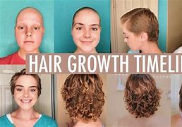 Image result for Vellus Hair Stages