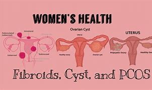 Image result for Pcod Cyst Size Chart
