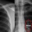 Image result for Chest X-Ray Outline