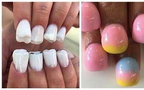 Image result for Ugliest Acrylics