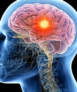 Image result for Viruses of the Mind
