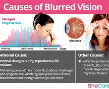 Image result for Blurred Vision Symptoms
