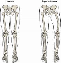 Image result for Medial Leg Anatomy