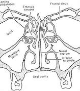 Image result for Sinonasal Cancer Staging