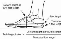 Image result for Foot Arch Chart