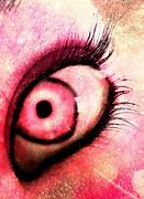 Image result for Pink Eye Animated