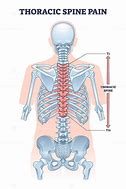 Image result for Thoracic Spine and Neck Pain
