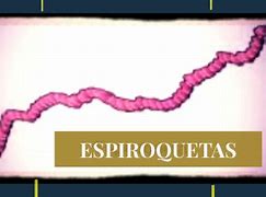 Image result for espiroqueta