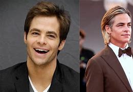 Image result for Chris Pine Plastic Surgery
