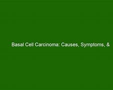 Image result for Basal Cell Carcinoma Pics