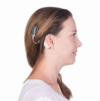 Image result for Cochlear Implant Hearing Aids