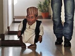 Image result for Thinnest Person in World