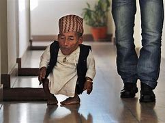 Image result for Thinnest Human