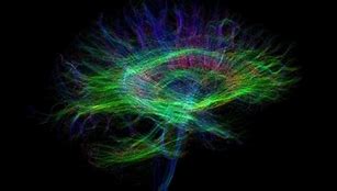 Image result for Universe Brain Poster