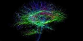 Image result for Cosmic Brain