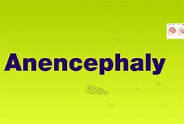 Image result for Anencephaly Nicu Baby