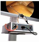 Image result for 4K Lens Unit Smith and Nephew 72205059s