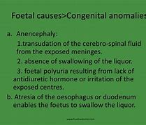 Image result for Anencephaly Symptoms