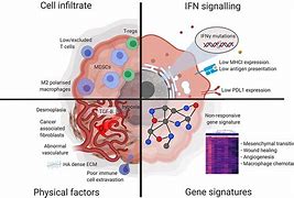 Image result for 1 Cm Tumor