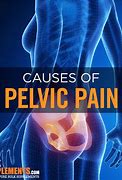 Image result for Chronic Pelvic Pain
