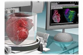 Image result for Impression 3D En Medecine