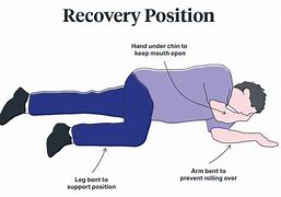 Image result for Recumbent Position CPR
