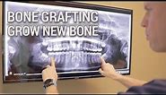 Dr. Pickup explains bone loss - do you have enough bone for dental implants?