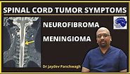 Spinal cord tumor symptoms. Neurofibroma. Meningioma. Spinal tumor specialist doctor.