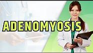 Adenomyosis: Understanding Symptoms and Exploring Treatment Options