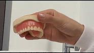 How to Apply Denture Adhesive or Denture Glue
