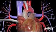 Coronary Artery Bypass Graft | Understanding Cardiovascular Disease