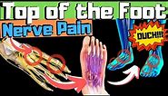 Sharp, Burning, Tingling Top of Foot Pain? [FIX Your Nerve Pain!]