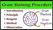 Gram Staining Procedure