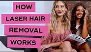 How Does Laser Hair Removal Work | LaserAway