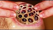 Trypophobia; Is It Real? (Extended Edition)