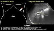 How To Scan The Spleen On Ultrasound | Probe Positioning | Transducer Placement | Abdominal USG