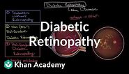 Diabetic retinopathy | Endocrine system diseases | NCLEX-RN | Khan Academy