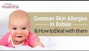 Common Skin Allergies in Babies & How to Treat Them