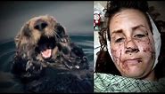 Woman Survives Vicious River Otter Attack