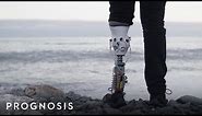 This MIT Engineer Built His Own Bionic Leg