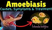 Amoebiasis | Amebiasis | Amoebic Dysentery – Symptoms, Causes, Treatment, Complications, Preventions