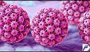 Metastatic HPV-linked head and neck cancer study