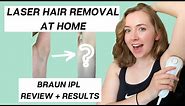 LASER HAIR REMOVAL AT HOME? IPL Review & Results (12+ Weeks) (Braun Silk Expert 5)