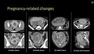 Gynecologic Radiology Anatomy