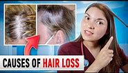What HAIR LOSS Says About Your HEALTH: Top 15 Causes of Hair Loss (Doctor Explains)