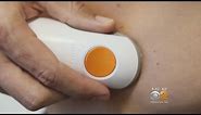 New Device Monitors Blood Sugar Levels